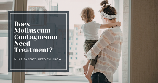 Does Molluscum Contagiosum Need Treatment? What Parents Need to Know